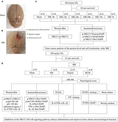 Inhibition of the NKCC1/NF-κB Signaling Pathway Decreases Inflammation and Improves Brain Edema and Nerve Cell Apoptosis in an SBI Rat Model